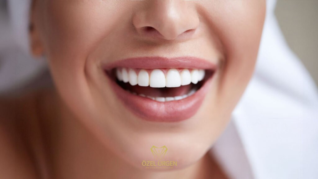 Diş Beyazlatma