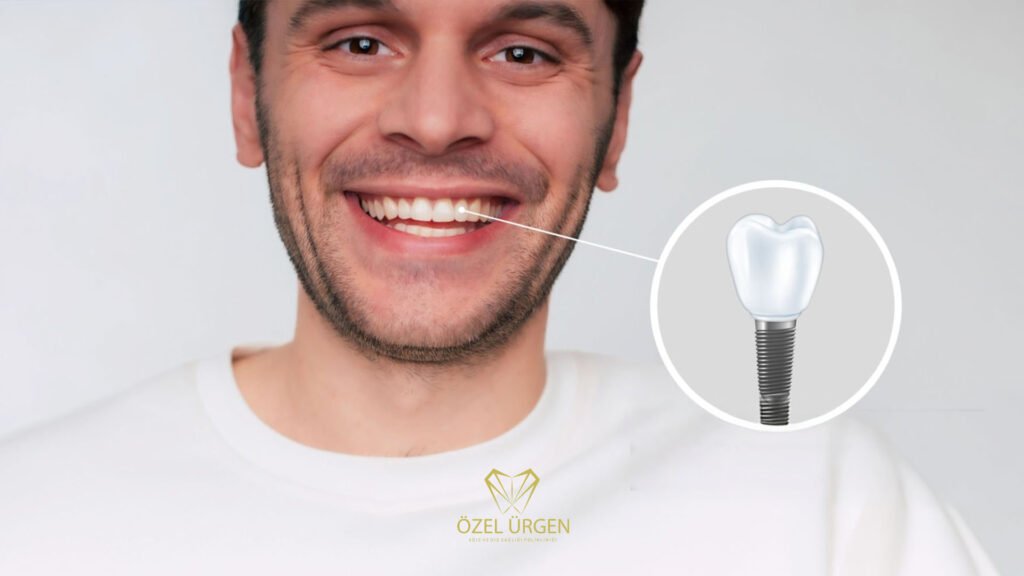 İmplant Tedavisi