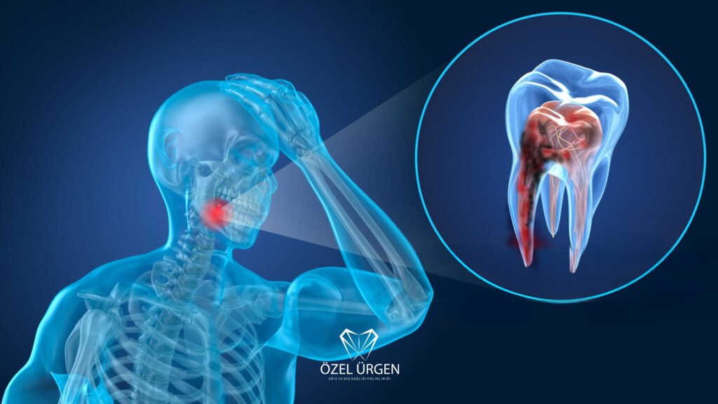 Diş Ağrısına Ne İyi Gelir? 