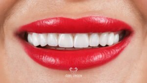 Zirkonyum ve Porselen Kaplama Farkı