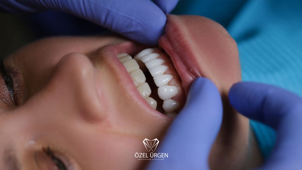 Zirkonyum ve Porselen Kaplama Farkı