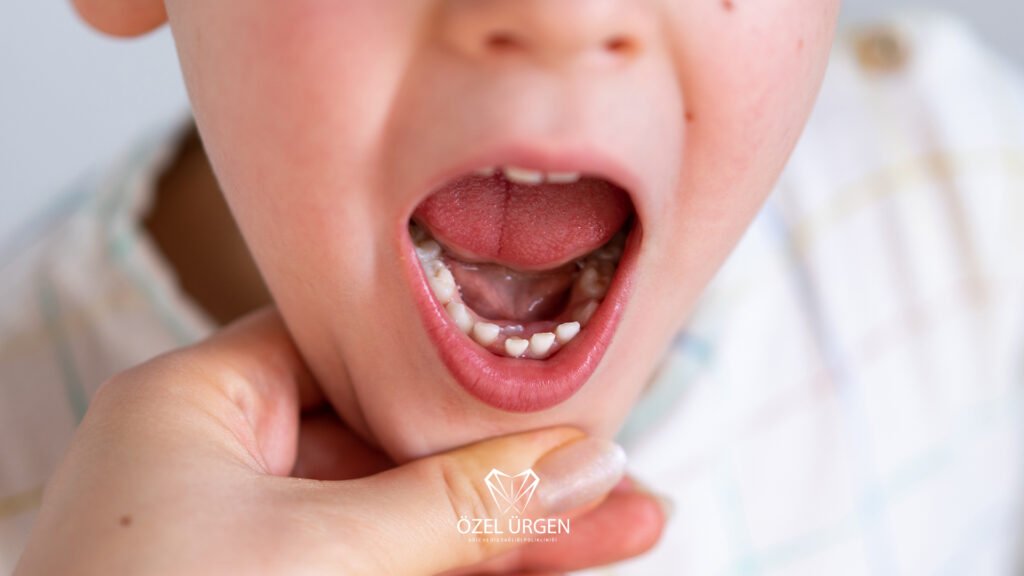 When Do Baby Teeth Fall Out