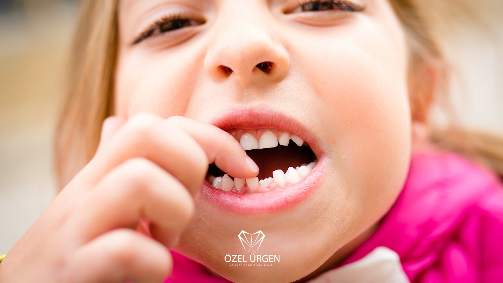 Süt Dişleri Ne Zaman Dökülür