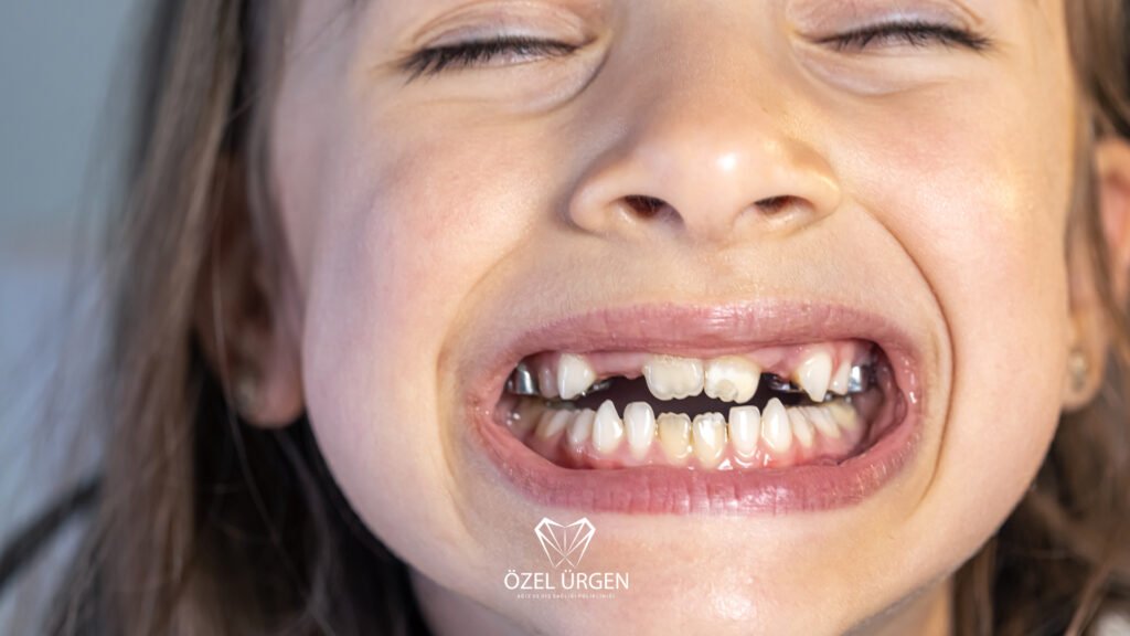 When Do Baby Teeth Fall Out