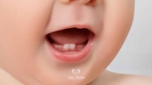 Bebeklerde Diş Çıkarma Dönemi