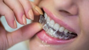 Şeffaf Plak Tedavisi