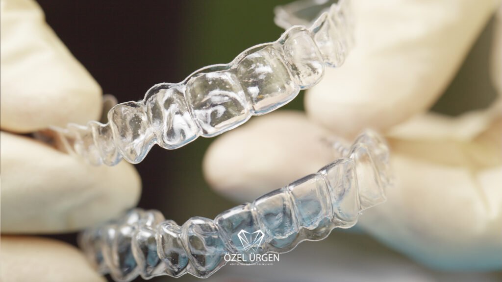 Clear Aligner Treatment