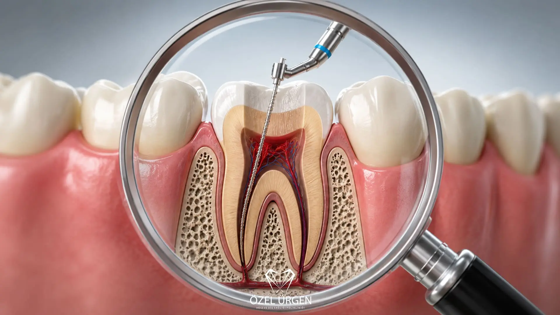 Root Canal Treatment: Symptoms, Stages and Process