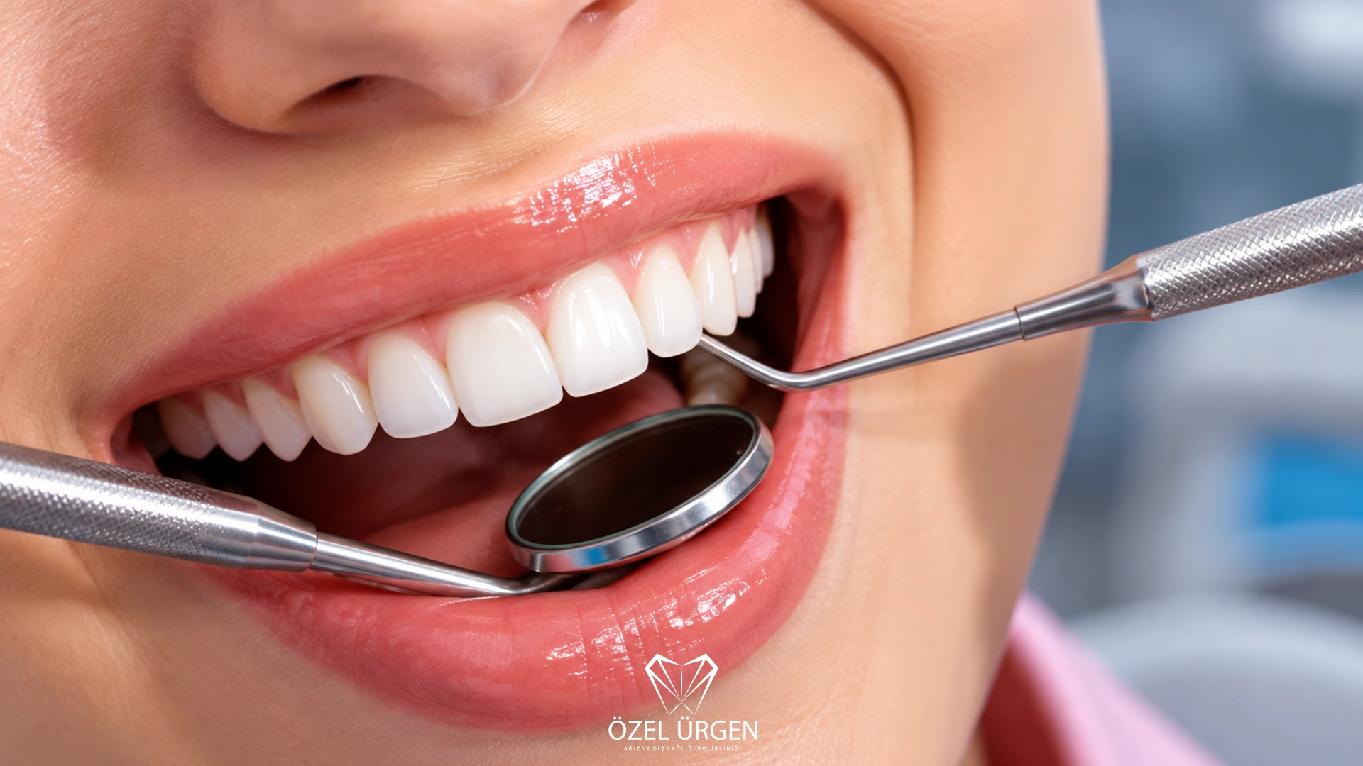 How Long Does Teeth Whitening Last? 6 Key Factors | Ürgen Dental Clinic