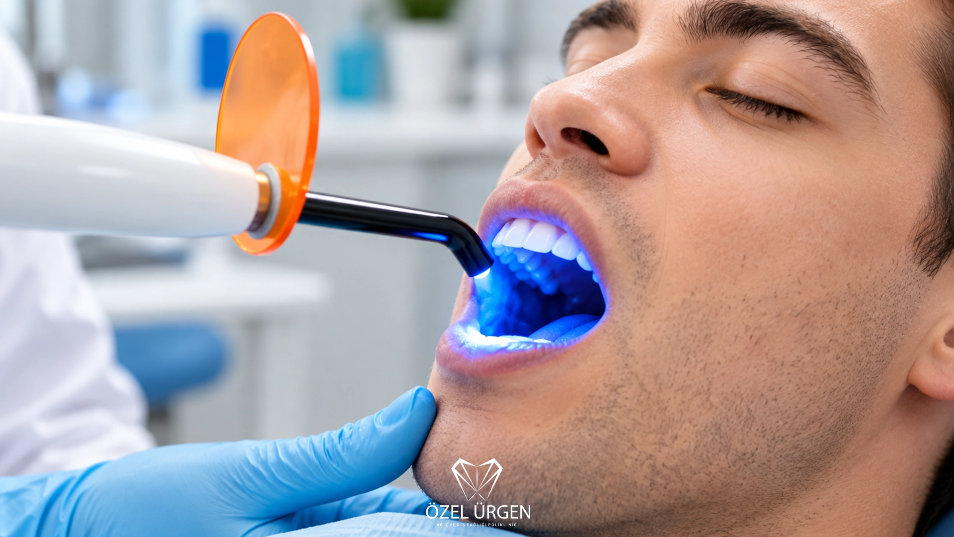 How Long Does Teeth Whitening Last? 6 Key Factors | Ürgen Dental Clinic