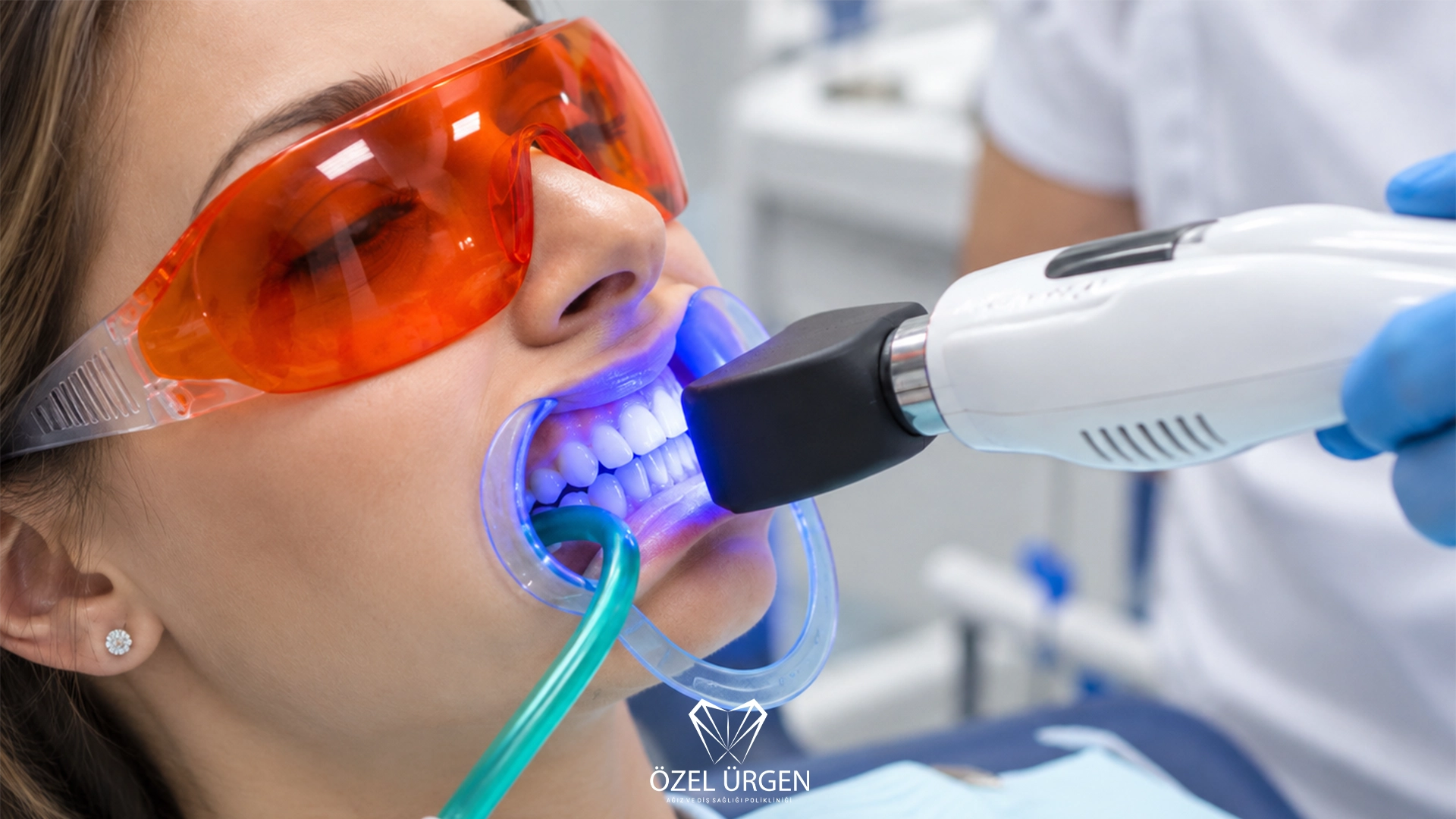 Is Teeth Whitening Harmful? 7 Important Facts